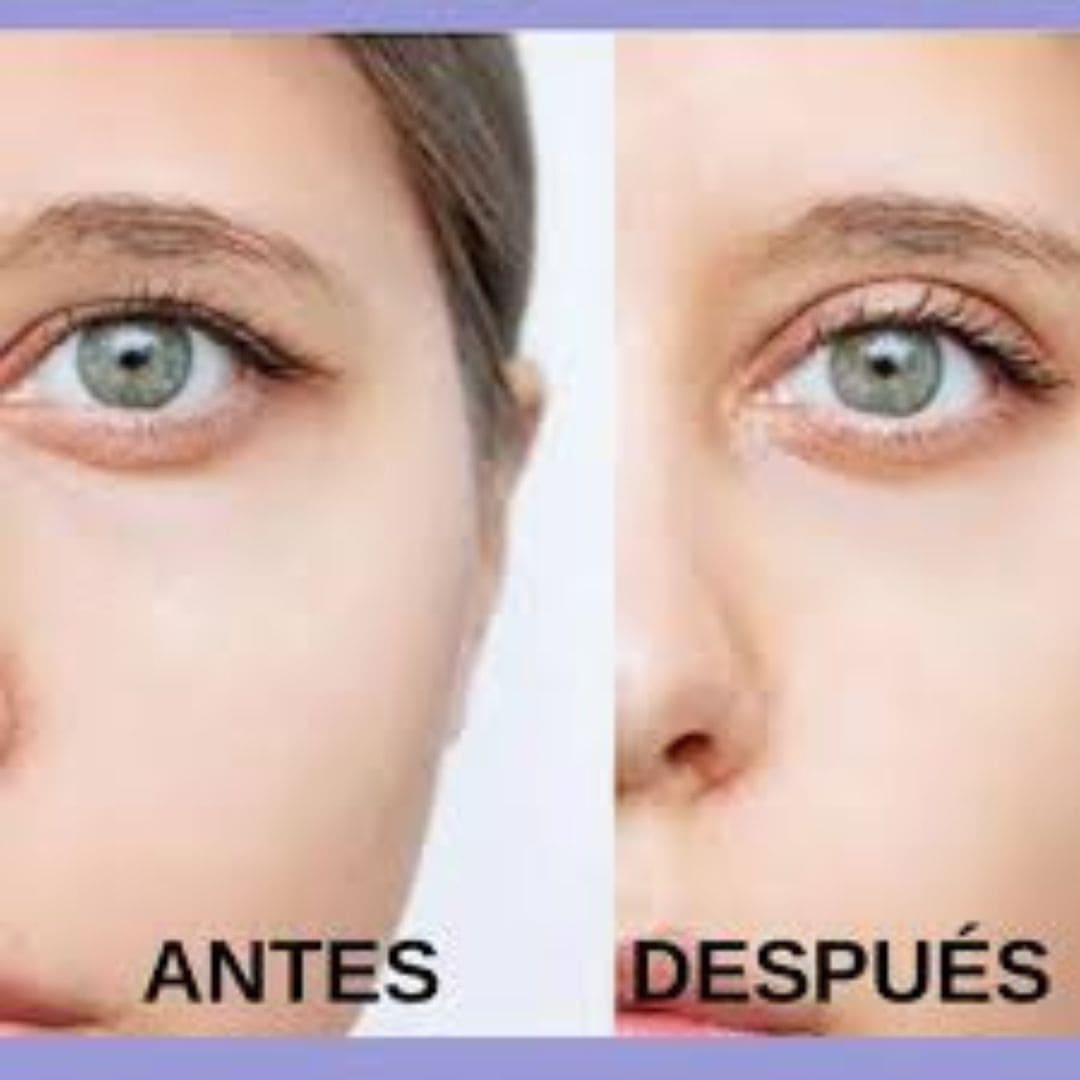 CINTAS LEVANTA PÁRPADOS CAÍDOS – PACK X 288 UNIDADES